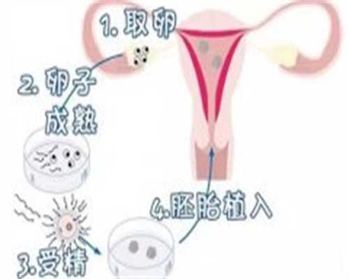 <strong>夫妻双方在试管婴儿助孕过程中是否都需要进行染色体检查？</strong>