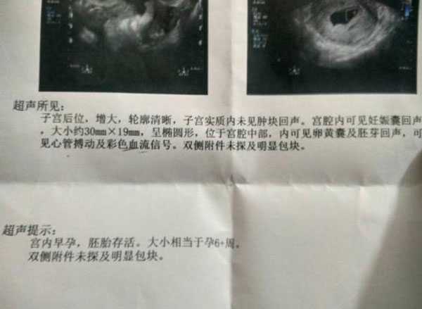 三穗县招聘代妈助孕_34岁女子一见钟情,第一次做试管婴儿,结果让人心酸
